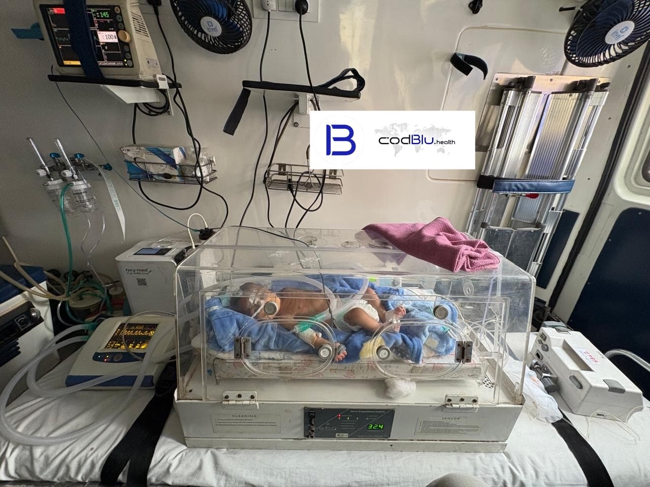 Truncus Arteriosus & Pneumonia in a Neonate – Critical Transfer From Lucknow to Delhi
