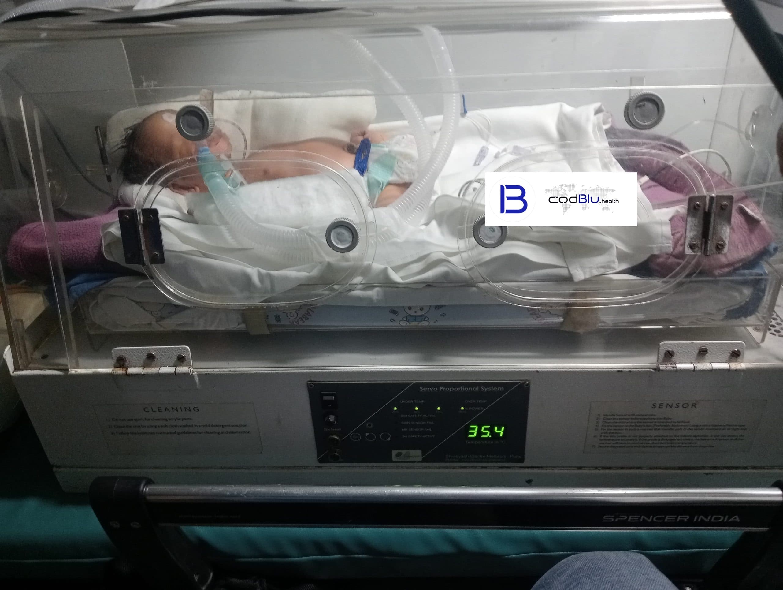 CodBlu Paediatric Ambulance Shifted Baby From Agra to Sir Ganga Ram Hospital, Delhi