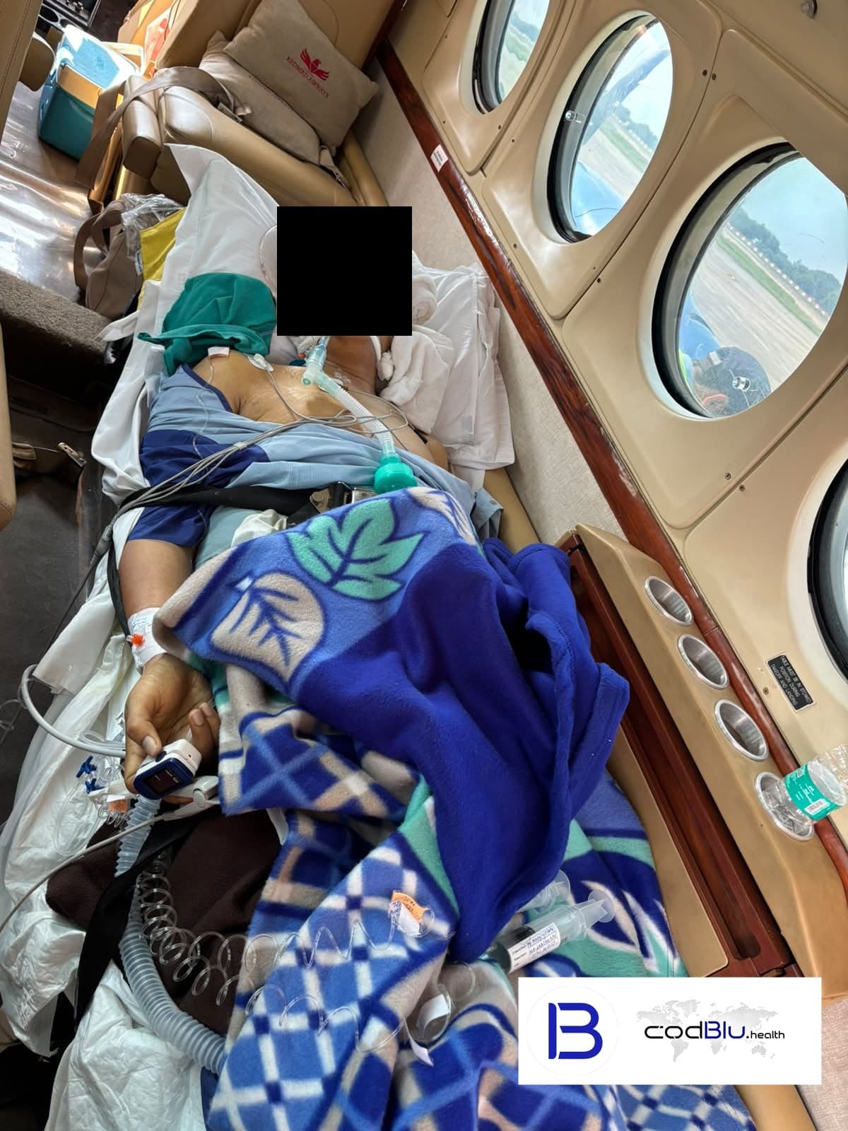 Max Hospital, Saket, Delhi – Mingalar Hospital, Mandalay | International Air Ambulance for Acute Liver Failure on Ventilator with Two Vasopressors